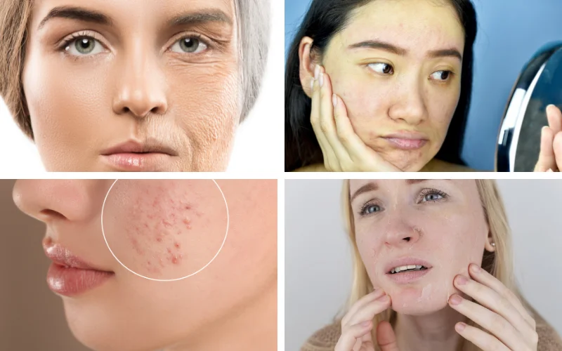 anti-aging-skin-concern